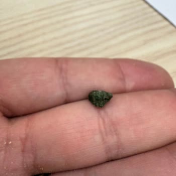 İçinde Taş Çıkan Kuruyemişte Diş Kırılması Ve Sağlık Tehlikesi