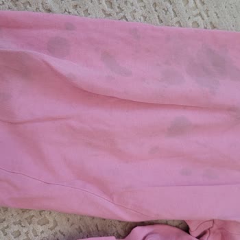 Siemens Çamaşır Makinem Yağ Lekesi Bırakıyor, Servis Sorunu Reddetti