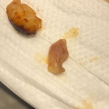 Çiğ Tavuk Teslimatı Ve Trendyol GO’nun Yetersiz Yanıtı