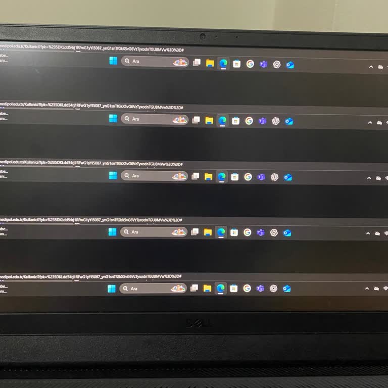 Dell G15 Dizüstü Bilgisayarın Arızası Ve Garanti Sürecindeki Çözüm Eksikliği