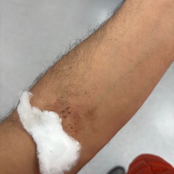 Hacettepe Acil Servisinde Hijyen Ve Personel İhmali