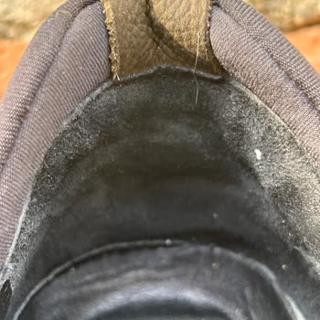 Derimod Ayakkabısının Topuğunda Şiddetli Ağrı Ve Yaraya Neden Olması