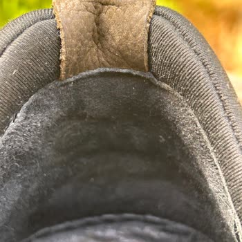 Derimod Ayakkabısının Topuğunda Şiddetli Ağrı Ve Yaraya Neden Olması