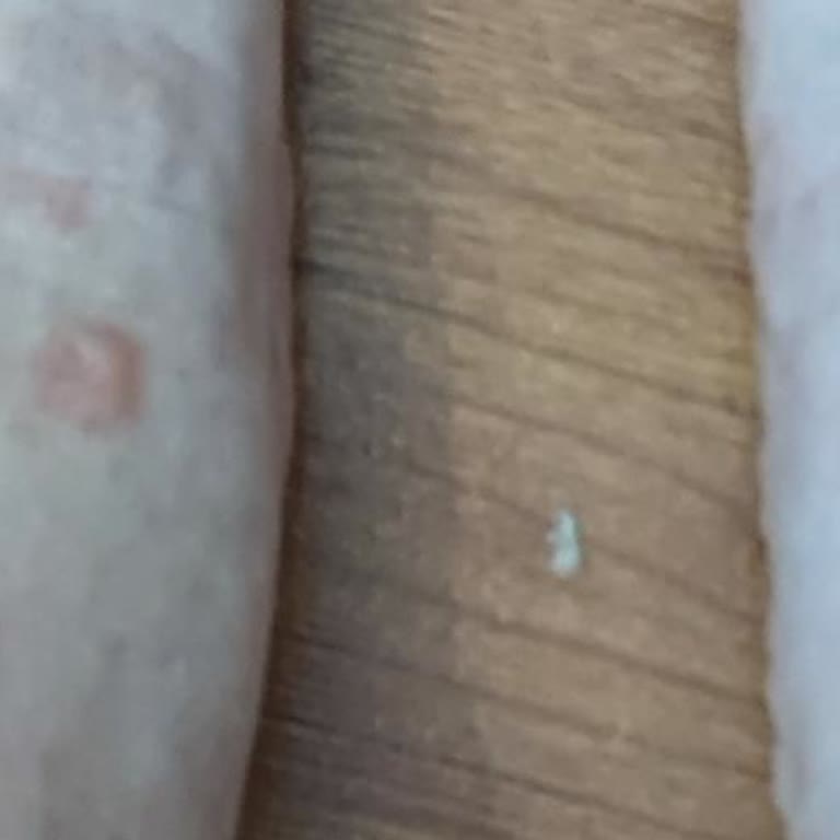 Ayaklarıma Vurup Acıtan Rahatsız Casual Ayakkabı