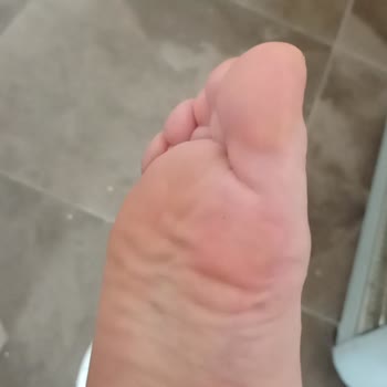 Kısa Süre Kullanımda Ayak Ağrısı Çeken Ürünün Değişim İsteği Reddedildi