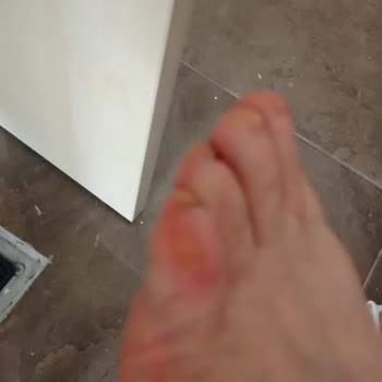 Kısa Süre Kullanımda Ayak Ağrısı Çeken Ürünün Değişim İsteği Reddedildi