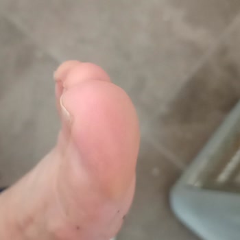 Kısa Süre Kullanımda Ayak Ağrısı Çeken Ürünün Değişim İsteği Reddedildi