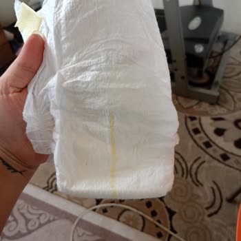 Prima Premium Care Bebek Bezinde Sahte Ürün Şüphesi Ve Geri Dönüş Yokluğu