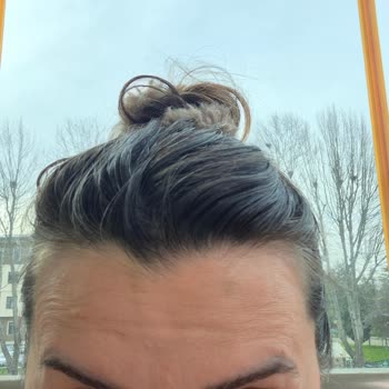 Dr. Belda Yurtseven Tüner Ek İşlem Talep Edilmesi