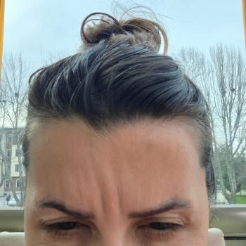 Dr. Belda Yurtseven Tüner Ek İşlem Talep Edilmesi