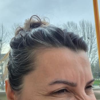 Dr. Belda Yurtseven Tüner Ek İşlem Talep Edilmesi