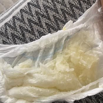 Molfix Ultra Pack’te Dikiş Eksikliği Ve Pamuk Topaklanması Bebeğin Cildine Zarar Veriyor