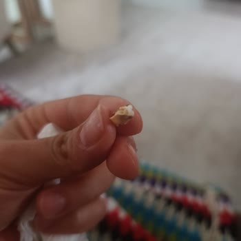 Lokumda Kocaman Antep Fıstığı Kabuğu, Sağlık Riski Ve İade Talebi