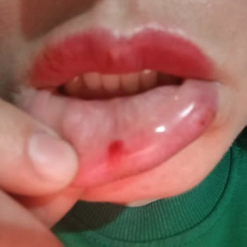 Kalıcı Makyajda Renk Tutmama Kanama Ve Hijyen Sorunları