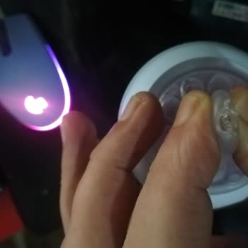 Bebek Sağlığı Tehlikede: Kusurlu Biberon Ve Yetersiz Müşteri Desteği