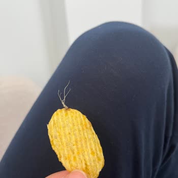 Ruffles Cipsinde Yabancı Kıl Tespiti Ve Hijyen Şikayeti