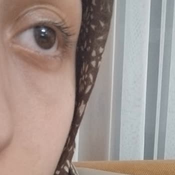 Estelia Vip Sakarya Sanki Hiç İşlem Yapılmamış Gibi Bir Sonuçla Karşılaştım