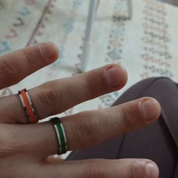 Estelia Vip Sakarya Sanki Hiç İşlem Yapılmamış Gibi Bir Sonuçla Karşılaştım