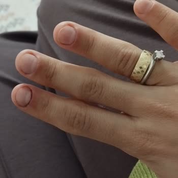 Estelia Vip Sakarya Sanki Hiç İşlem Yapılmamış Gibi Bir Sonuçla Karşılaştım