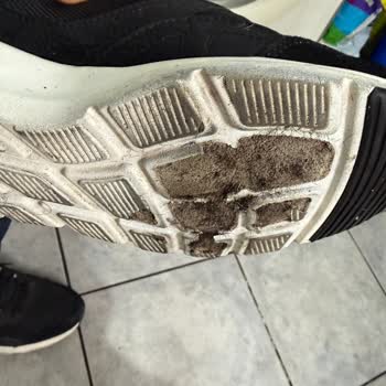 Boyner Skechers Ayakkabısının Kısa Sürede Parçalanması Ve Haksız İnceleme Kararı