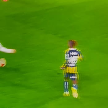 Tekrarlayan Görüntü Arızaları Ve Yetkili Servisin Çözüm Eksikliği