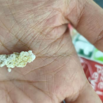 Lor Peynirinde Renkli Topaklar Ve Hijyen Sorunu