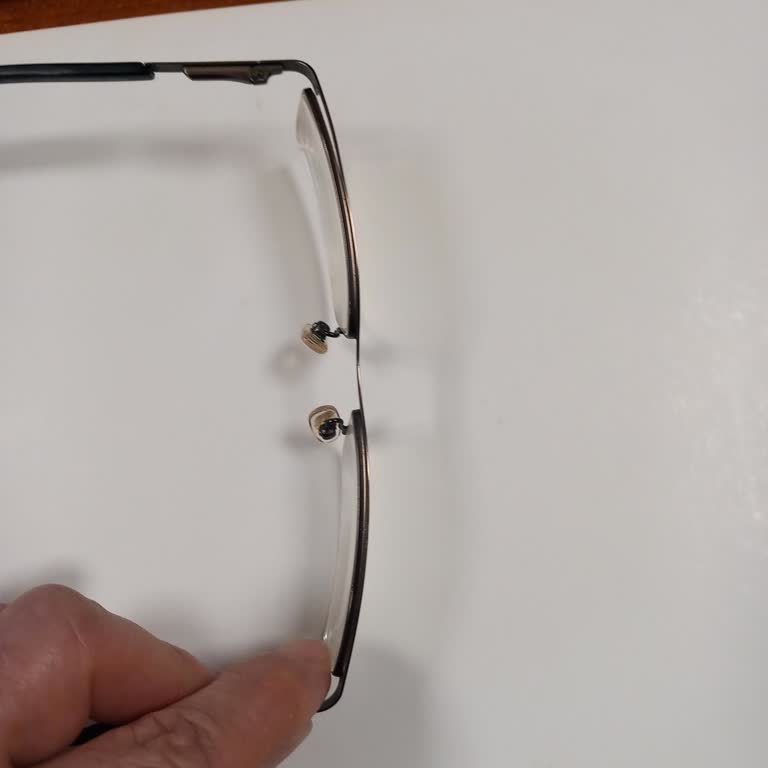 Garanti Kapsamındaki Çerçeve Arızası Ve Ek Lens Ücreti