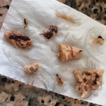 Bozulmuş Ton Balığı Konservesi Sebebiyle Sağlık Endişesi Ve Ücret İadesi Talebi