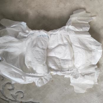 Molfix Bebek Bezinde Kesikler Ve Güvenlik Endişesi