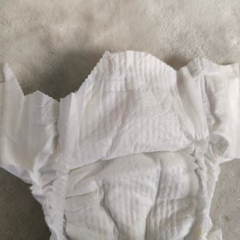 Molfix Bebek Bezinde Kesikler Ve Güvenlik Endişesi