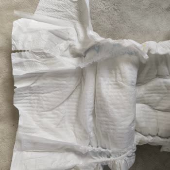 Molfix Bebek Bezinde Kesikler Ve Güvenlik Endişesi