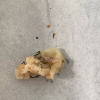 Subway Tavuk Teriyaki İçinde Kemik Bulunması Ve Ürün Kalitesi Şikayeti