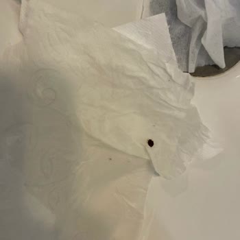 Ramada Wyndham İskenderun’da Tahta Kurusu Ve Hijyen İhmaline Şikayet