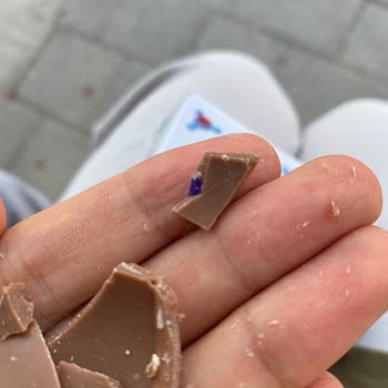 BİM Sürpriz Yumurta'da Plastik Parça Çocukları Tehlikeye Attı