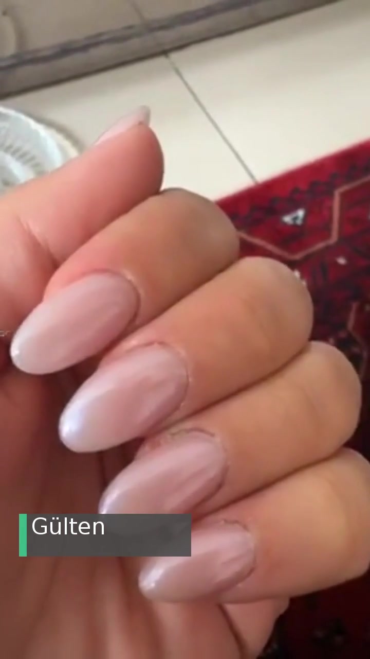 Mediclinic's (Maltepe) Jel Tırnak Hüsranı! videonun kapak resmi