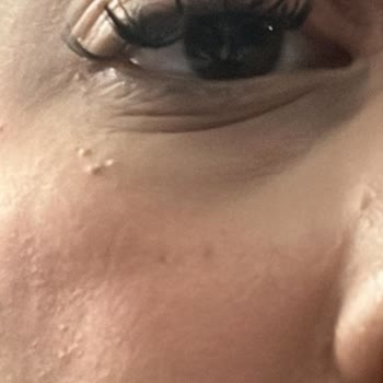 Gökben Özcan Beauty İpek Kirpik İşlemi 24 Saatte Bozuldu, Yeniden Düzeltme Talep Ediyorum
