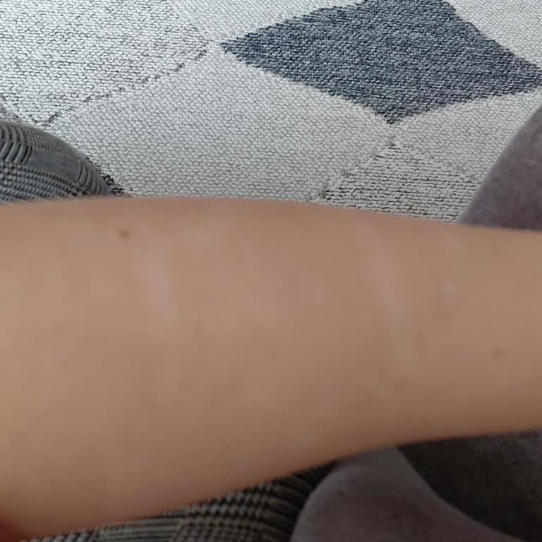 Halise Korkmaz Güzellik Salonu Tüylerimde Neredeyse Hiçbir Fayda Görmedim