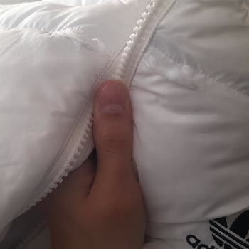 Adidas Online Siparişimde Gelen Defolu Mont İçin Hızlı Değişim Talebi