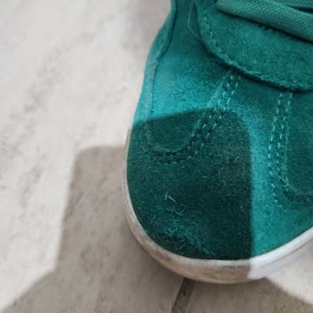 Adidas Sneaker’da Başparmak Yırtığına Üretim Kusuru İddiası Ve Değişim Talebi