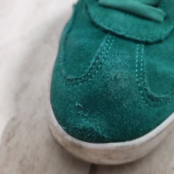 Adidas Sneaker’da Başparmak Yırtığına Üretim Kusuru İddiası Ve Değişim Talebi