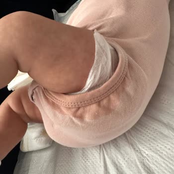 Molfix Premium Smart Fit Bezlerinde Sürekli Sızdırma