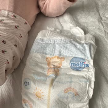 Molfix Premium Smart Fit Bezlerinde Sürekli Sızdırma