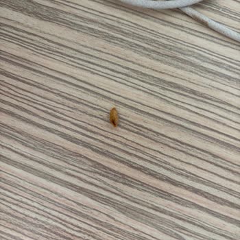 Noodle Paketinde Bulunan Kurtlar Ve Sağlık Endişesi