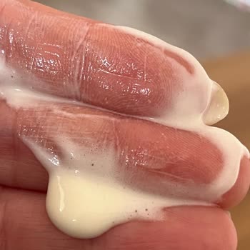 Son Kullanma Tarihi Geçmemiş Dondurmalarda Bozulma Ve Boğaz Kaşıntısı