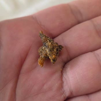 Patos Nacho Cipsinde Yabancı Madde Bulunması Ve Hijyen Şikayeti