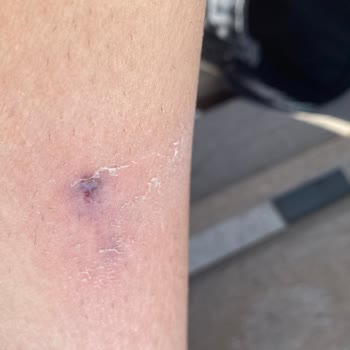 Konya Tramvay Şoförünün Kapı Kapatma İhmalinden Bacak Yaralanması