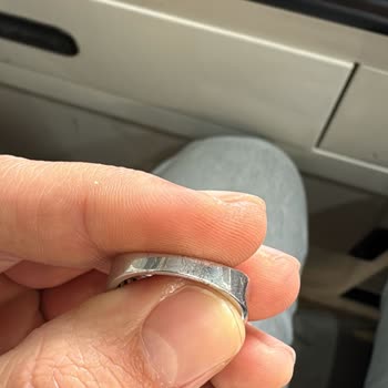 Zen Gümüş Yüzükte Hızlı Kararma Ve Siyah Lekeler, İade Ve Telafi Talebi