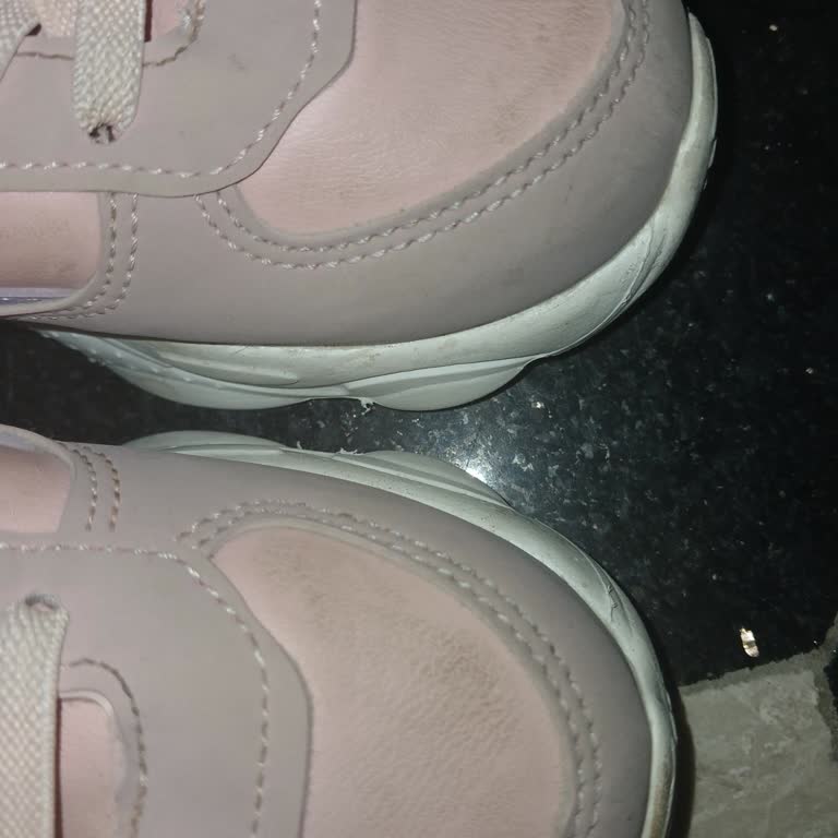 Ayakkabı Dikişlerinden Kaynaklanan Ayak Ağrısı İçin İade Ve Değişim Talebi