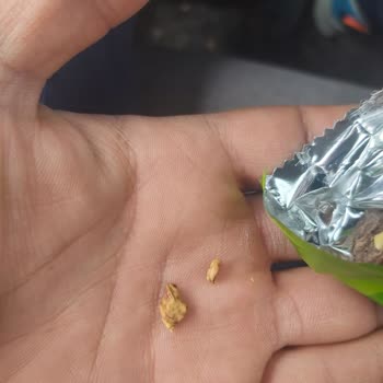 Çikolata İçinde Kabuk Çıktı, Dişim Zarar Gördü Ve Eti'den Cevap Alamadım