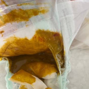 Evolvia Nutripro Bebek Maması Alerjik Reaksiyon Ve Ücret İadesi Talebi